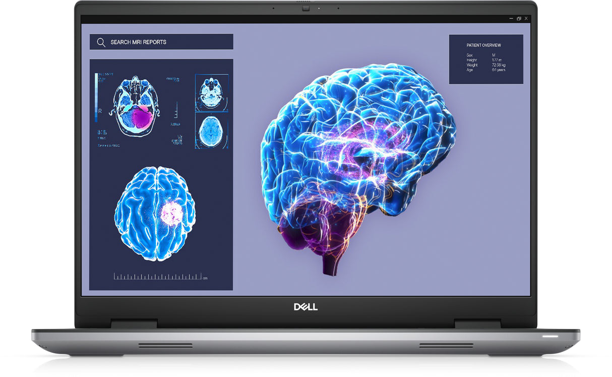 DELL Precision 7680 Intel® Core™ i7 i7-13850HX Mobile workstation 40.6 cm (16") Full HD+ 32 GB DDR5-SDRAM 512 GB SSD NVIDIA RTX A2000 Wi-Fi 6E (802.11ax) Windows 11 Pro Grey - 091RP
